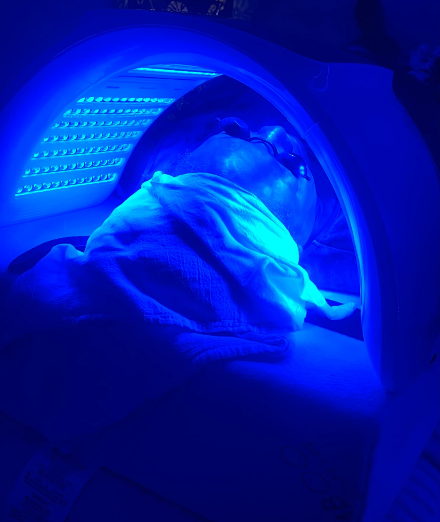 Chemical Peel Facial