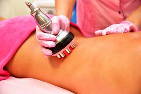 RF Skin Tightening
